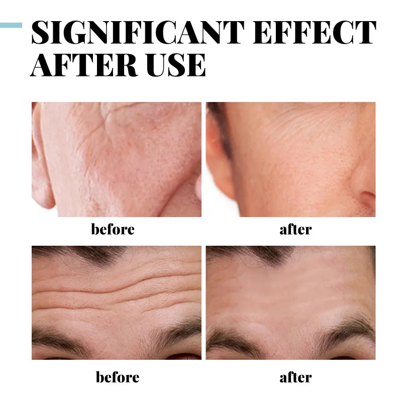 Anti Wrinkle Face Cream Collagen
